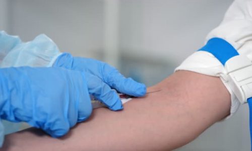 Close up shot of hands of nurse in disposable gloves drawing venous blood from arm of female patient, removing needle and pressing down on vessel with sterile gauze pad